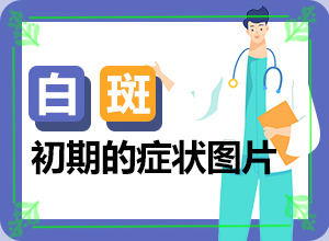 大腿外側(cè)有白斑[大揭秘]治白癜風哪里效果好