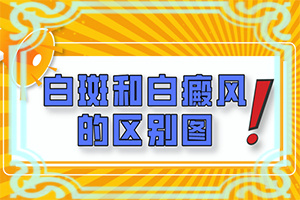 怎樣區(qū)分白斑和白癩風(fēng)[主要區(qū)別是什么]白癲瘋是什么癥狀？