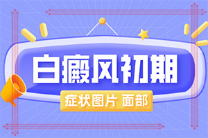 小面積的白癜風(fēng)好治嗎[又有哪些癥狀表現(xiàn)呢]白癩風(fēng)圖片早期