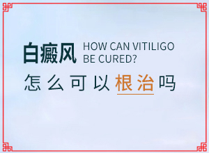 白癜風(fēng)的誘因如何檢查出來-具體的誘因有哪些