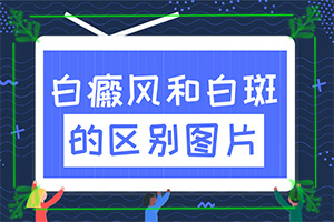 皮膚有點白班[檢查哪些癥狀]小孩脖子有白班