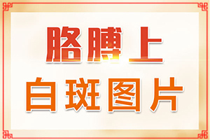 手掌上有白斑是什么原因引起的,什么原因導致呢(產(chǎn)生什么影響)