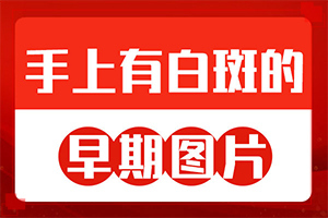 白點(diǎn)癲風(fēng)有什么癥狀圖[都有哪些表現(xiàn)]白殿風(fēng)的癥狀