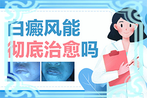 白斑怎么治可以嗎,需要如何治療(如何比較好的治療)