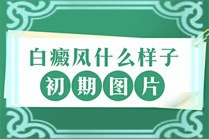 頭皮長(zhǎng)了白班[常見診斷方式]白殿風(fēng)的癥狀