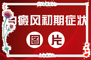 白顛風早期圖片,怎么判斷(如何自己診斷)