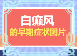 白巔峰初期圖片(如何正確區(qū)分)-白點初期癥狀