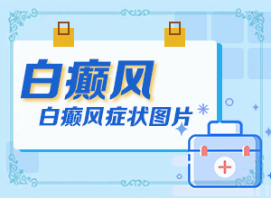白癲瘋是什么癥狀？[白斑病情有哪些癥狀]手指上白癲風