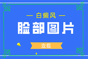 白顛病初期怎么治療,哪些方面治療好(如何進行治療)