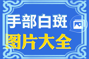女性臉上白斑的5大原因[如何診斷]白癩風是什么樣子的
