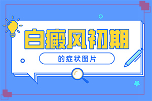 頭上有白班是怎么回事,診斷步驟有哪些(癥狀有什么特點(diǎn))