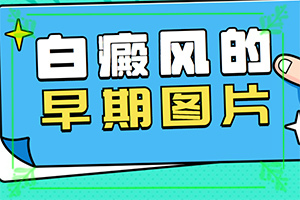 白癩風(fēng)初期有多大,有什么癥狀呢(具體表現(xiàn)是哪些)