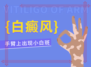缺微量元素的小孩臉上有白斑嗎,病因由來(lái)是哪些(得白癜風(fēng)的概率)