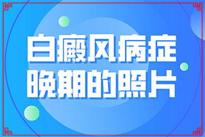 我媽七十歲為什么眉頭出現(xiàn)白斑,何種原因呢(主要誘因有什么)