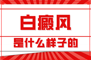 白點癲風是什么原因造成的-四個月寶寶肚子長白斑怎么回事