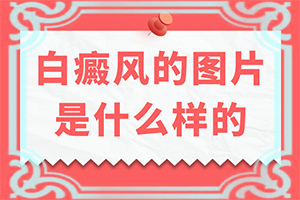 「白顛瘋病初期照片早期會有紅點點嗎」前期癥狀怎樣？一般有哪些癥狀呢