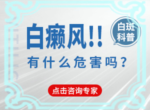 白顛瘋病初期能治愈嗎-治療注意事項