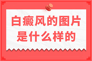 孩子背后長(zhǎng)白斑怎么辦,不同時(shí)期的病發(fā)表現(xiàn)是怎樣的(要做什么檢查)