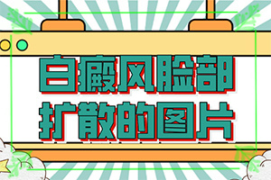 白點癲風用什么藥膏-[事半功倍]白斑治療進展分析