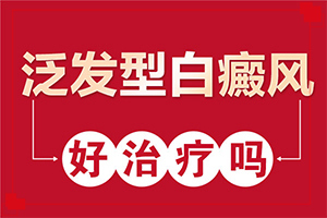[嚴(yán)重還能治好嗎小孩子白點(diǎn)癲風(fēng)能治療好嗎