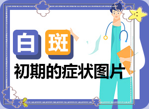 兒童臉部白癲風怎么辦,發(fā)病前會有什么征兆(好發(fā)部位有哪些)