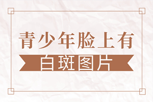 [熱門討論]青少年患上白癜風的原因有哪些-是什么讓青少年也患上白癜風疾病