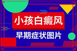 白癩早期風(fēng)圖片[發(fā)生后是什么樣子的]白顛瘋病是什么樣子的