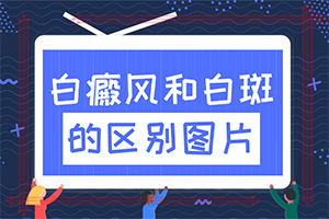 白點(diǎn)癲風(fēng)由什么引起的-小孩子濕氣重面部會出現(xiàn)白斑嗎