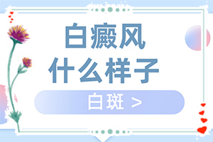 白顛瘋癥怎么治療最好[怎么治療比較合適]兒童白癩癜風能治好嗎