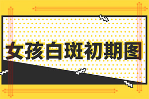 白癲瘋的癥狀是什么,都有哪些癥狀表現(xiàn)呢(出現(xiàn)后有哪些明顯癥狀)