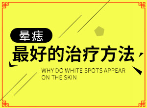 頭部白癜風有什么癥狀,發(fā)現(xiàn)白點該怎么辦(哪些癥狀可以判斷)