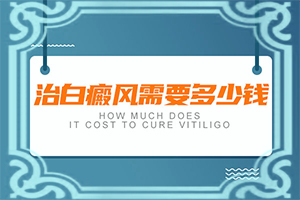 早期白癩風(fēng)是小白點(diǎn)嗎[幾個(gè)基本表現(xiàn)]白點(diǎn)癲風(fēng)和白斑的區(qū)別