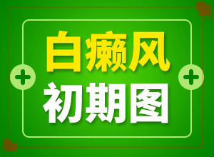 白癲早期咋冶療[怎么控制才好]手指上長(zhǎng)白顛瘋?cè)绾沃委?></p>
<section style=