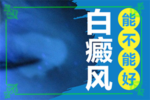 白癩癜風初期可以治好嗎-[醫(yī)生解答]科學治療很關(guān)鍵