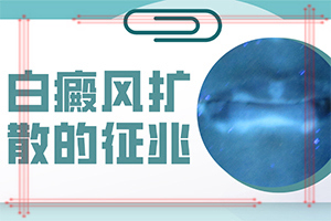 白顛如何治療[可以用什么來(lái)治療]治白巔峰的治療方法