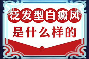 白殿病是怎么引起的-2歲男童白癜風(fēng)母親遺傳好治嗎