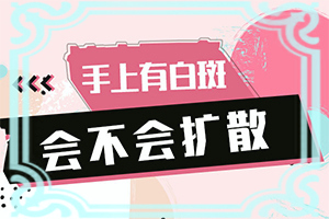 白癲治療最佳醫(yī)院[應(yīng)該怎么治療和防護(hù)]白顛瘋病初期能好嗎?