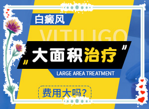 遺傳白巔峰治療法[能盡快治療好嗎]治療白癲瘋大約多少錢(qián)