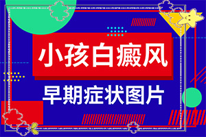 [嚴重還能治好嗎手上一年多白斑怎么治呢