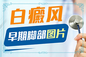 60歲腿上長(zhǎng)白斑了是怎么回事-女生最近臉上有白斑是怎么問(wèn)題
