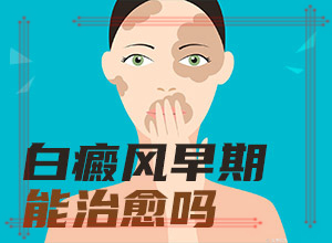 白癜風(fēng)遺傳的幾率大不大-曬了一個月臉上有白斑怎么回事