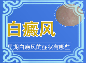 怎樣判斷是不是白癩風(fēng),怎樣判斷癥狀(具體表現(xiàn)有哪些)