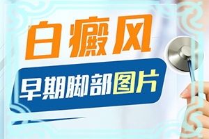 嘴皮長白斑是怎么回事,早期診斷方法(區(qū)別怎樣區(qū)別辨識(shí))