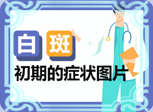 小面積的白癜風好治嗎[典型表現(xiàn)]皮膚上長白班什么原因