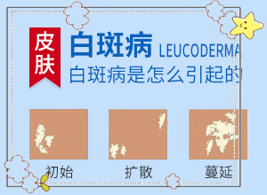 白癩病的圖片,白斑病情有哪些癥狀(會有什癥狀)