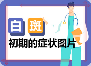 手掌背面長(zhǎng)白癲風(fēng),在初期時(shí)期是什么樣的(有什么好的診斷方法)