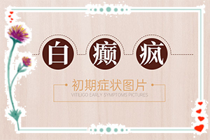 兩歲半寶寶臉上有白斑是缺鋅嗎,原因有哪些(發(fā)作原因是哪些)