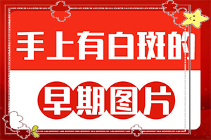 白癩風(fēng)是什么樣子的,什么樣(診斷步驟是什么)