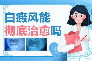 白點癲風的圖片[容易被忽視癥狀有哪些]白癲風的癥狀是什么