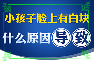 [如何正確治療白斑]兒童白殿瘋能治療好嗎